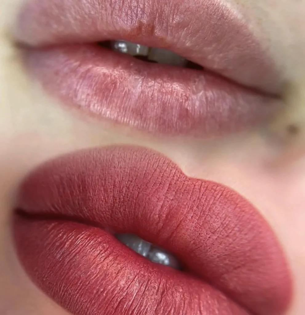 Harry Crowder | What Happens If You Smoke After Getting Your Lips Done? lip blush before and after