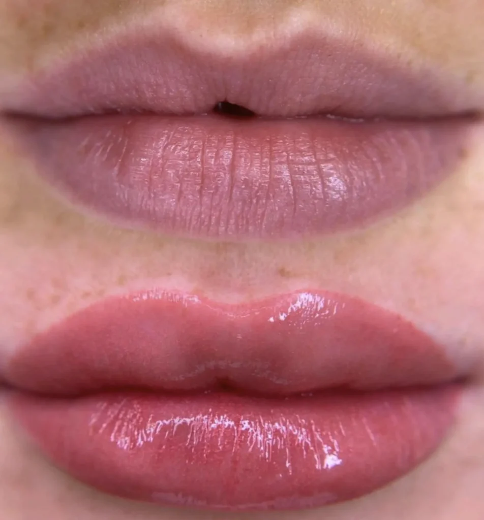 Harry Crowder | What Happens If You Smoke After Getting Your Lips Done? lip blushing before and after