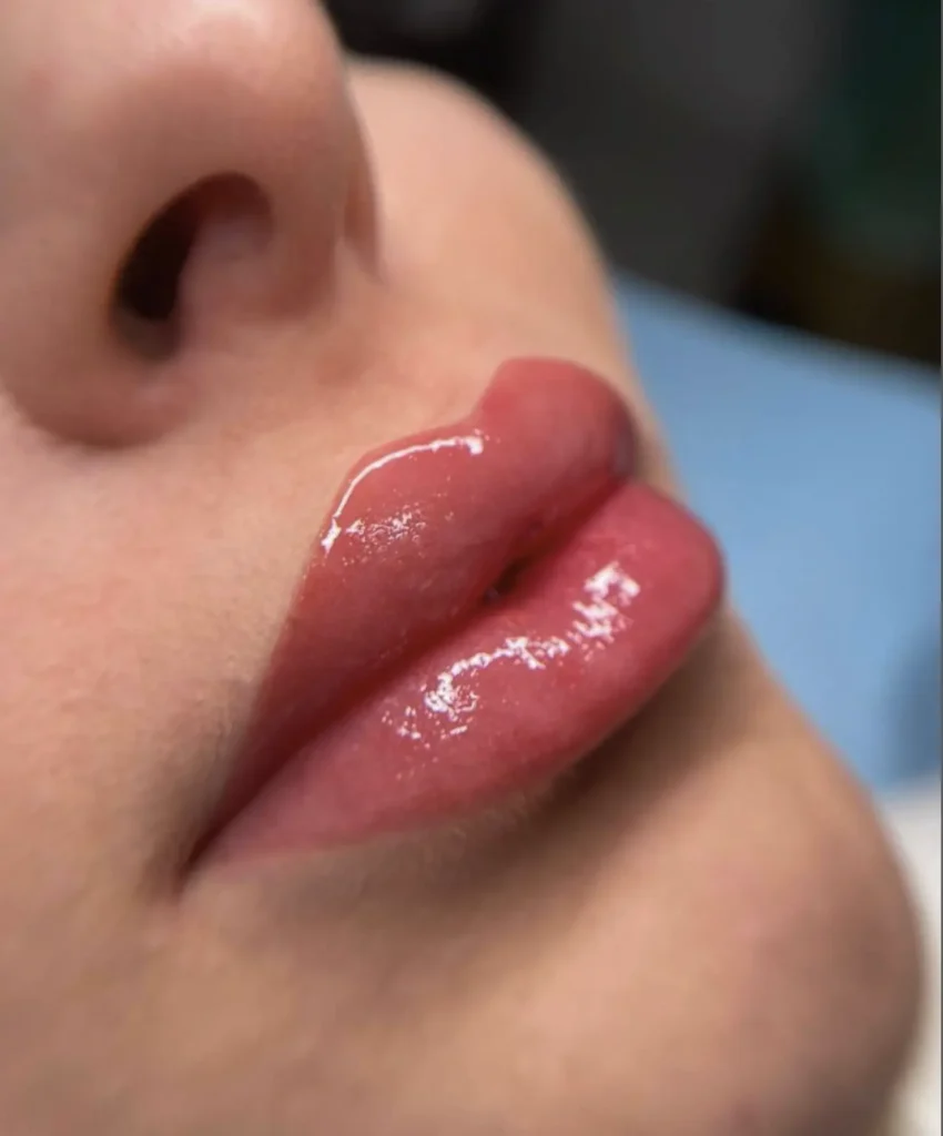 Harry Crowder | What Happens If You Smoke After Getting Your Lips Done? lip tint tattoo